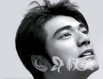 长沙美莱鬓角植发价格 术后注意事项