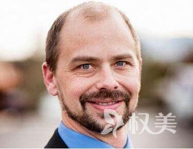 植发危害有哪些 广州广大亿美做鬓角种植安全吗