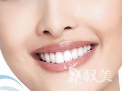 牙齿冷光美白黄牙如何迅速变白 北京佳美口腔医院牙齿美白技术好不好
