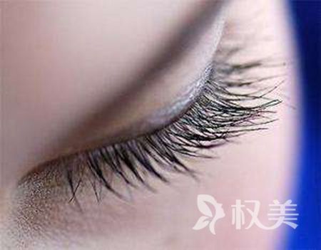 睫毛种植人人都可以做吗 西安西京医院植发科好不好