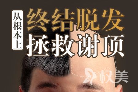 杭州华山连天植发医院怎么样 有植发经历的吗