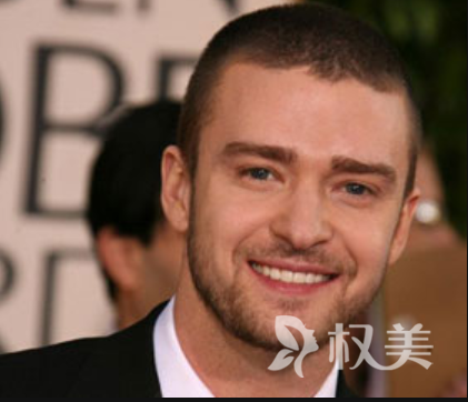 胡须种植后多久可以生长 南京科发源植发效果好吗
