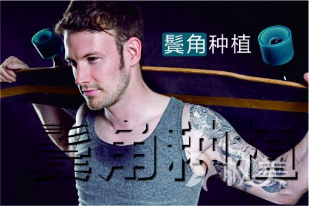 植鬓角大概多少钱 天津植鬓角哪家医院比较好