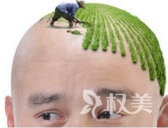 广州华美植发医院头发种植有哪些方法  有没有后遗症呢