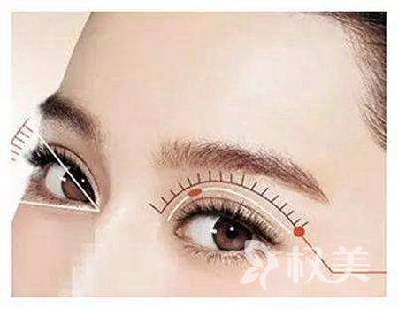 三眼皮怎么修复 玉林华美整形医院双眼皮修复方法