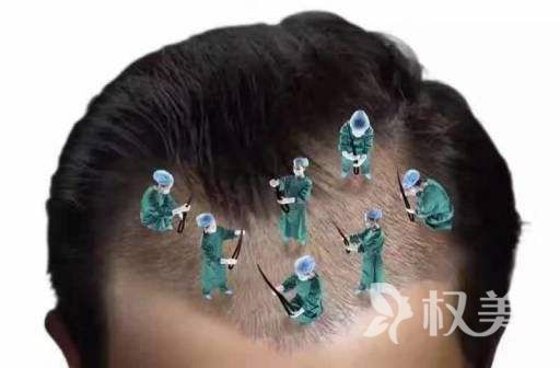 杭州脱发治疗安全吗 杭州哪家植发医院头发种植不留疤