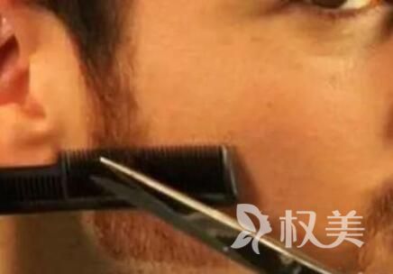 鬓角秃怎么办 石家庄博士园毛发移植医院鬓角种植好吗