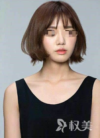 脱发困扰如何解决 长沙美莱美容医院植发整形科植发价格