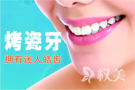 烤瓷牙哪种好 北京美莱医院口腔整形烤瓷牙自然吗