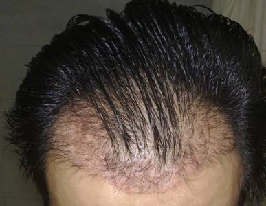 种头发多少钱，10元左右一根！