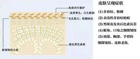 你以为秋季只有干燥危