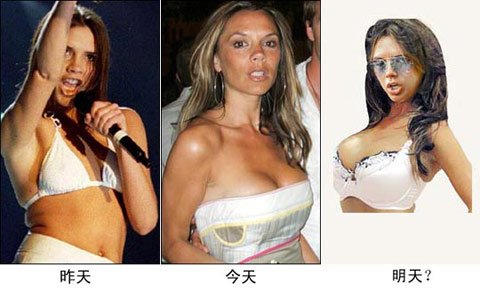 明星夫妻为整形狂
