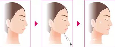 侧脸怎么整？照这个标准来