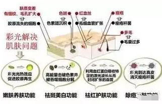 彩光嫩肤每次间隔不能太短吗