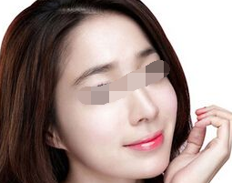 面部脱毛为什么要选择光子脱毛