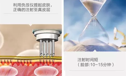 sg注射美白成效如何?