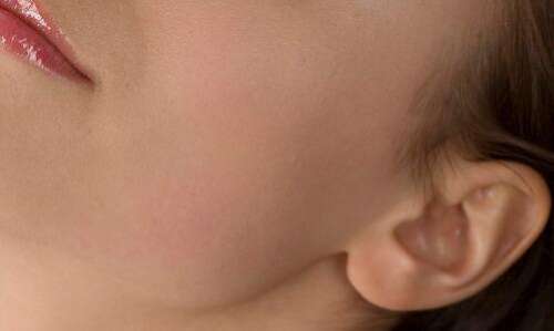 台州临海蒋氏耳垂畸形修复方法有几种
