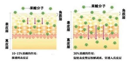 做了果酸换肤后皮肤变薄吗