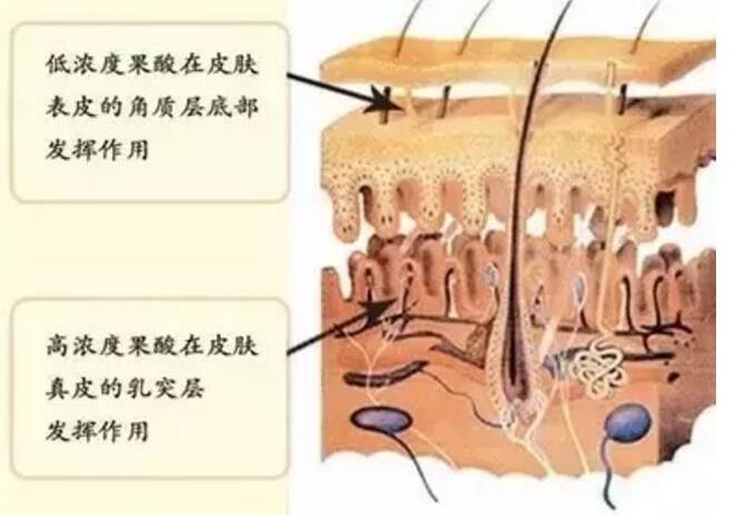 果酸换肤后会不会老化的更快呢