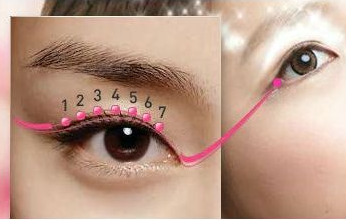 青岛诺德韩式双眼皮是永久的吗