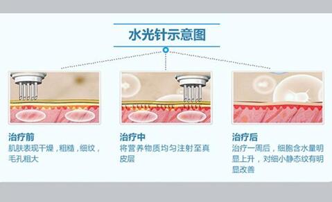 粗汉子也一样清丽脱俗--sg