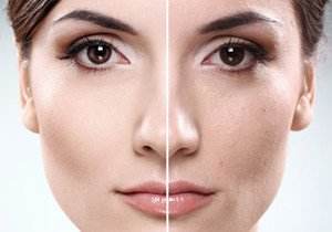 皮肤粗糙怎么改善 彩光嫩肤的功效