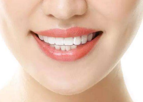 冷光美白牙齿能保持多久 注意事项有哪些