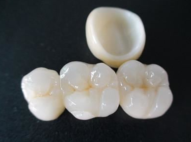 上海德伦种植牙效果如何 成熟的种植修复治疗手段