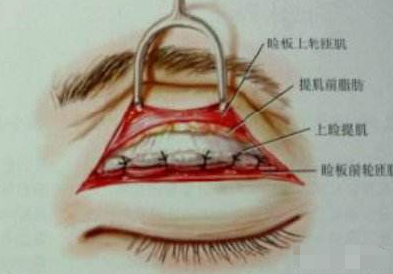 上海韩镜医疗美容医院在哪 双眼皮修复需要多少钱
