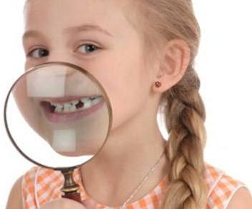 牙齿畸形都有什么危害 不要因为你的无知让孩子口腔不健康