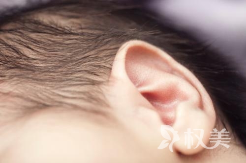 小耳畸形怎么矫正 多久能恢复