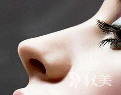 重庆江陵医院整形科做鼻尖 让鼻子更协调