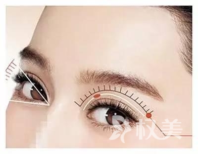 喜善美眼双眼皮手术满足不同爱美者需求 涵盖了韩国6种美眼方案