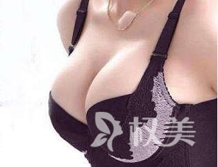 重庆武警总队医院整形科美胸隆胸 让胸部更高挺