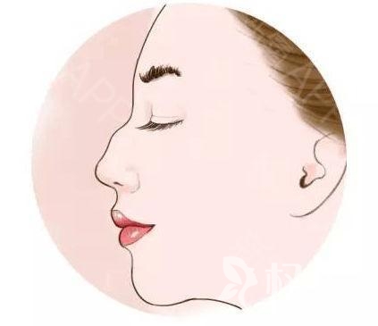 驼峰鼻矫正费用是多少 驼峰鼻矫正后会有疤痕吗