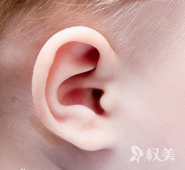 耳部整形哪里好 耳廓畸形矫正有哪些方法?什么时候做