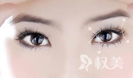 韩式双眼皮 和明星同款美眼 效果更自然