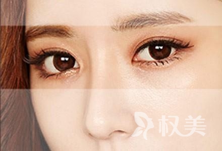 韩式双眼皮的效果怎么样呢 韩式双眼皮和全切双眼皮有什么区别呢