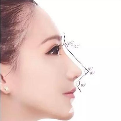 硅胶隆鼻费用是多少 假体形状常用的有L形、T形及柳叶形
