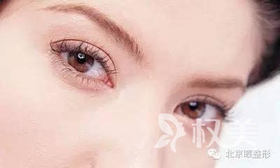 北京做双眼皮哪个季节恢复快 埋线双眼皮成功率高吗