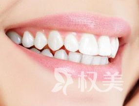 种植牙和传统镶牙的区别有哪些 不再缺失笑容的美丽