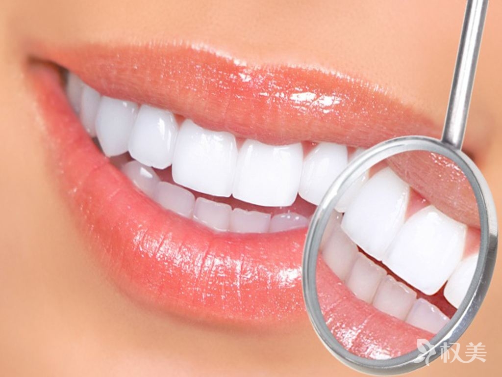 美容冠牙齿矫正价格是多少 能保持多久