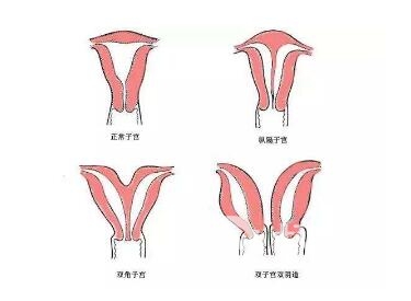 广东药学院附属新医院阴道再造术手术有哪些优势  术后要怎么护理