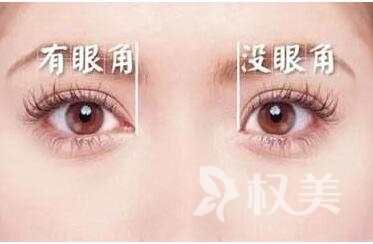深圳人民医院整形外科做开眼角手术后效果很自然吗  有哪些后遗症呢