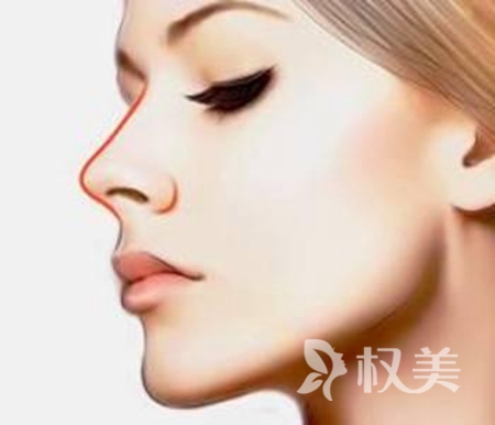 硅胶隆鼻一般多少钱 硅胶隆鼻能保持多久