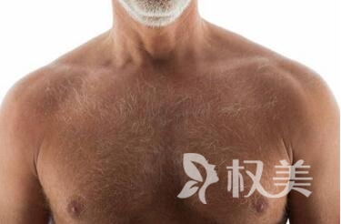 广州新发现植发医院地址 种植胸毛安全吗多少钱